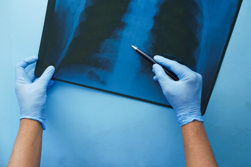 Ewolucja metod badawczych - Radiografia w laboratoriach